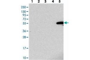 Western blot analysis of Lane 1: RT-4, Lane 2: U-251 MG, Lane 3: Human Plasma, Lane 4: Liver, Lane 5: Tonsil with IGSF11 polyclonal antibody . (IGSF11 Antikörper)