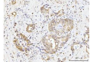 IHC analysis of Nucleostemin/GNL3 using anti-Nucleostemin/GNL3 antibody (ABIN7601778). (Nucleostemin Antikörper  (AA 45-549))