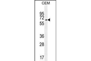 UNCX Antibody (C-term) (ABIN655115 and ABIN2844746) western blot analysis in CEM cell line lysates (35 μg/lane). (UNCX Antikörper  (C-Term))