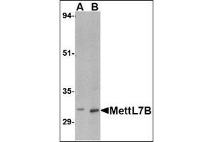 Western blot analysis of MettL7B in rat spleen tissue lysate with MettL7B antibody at (A) 2 and (B) 4 µg/ml (METTL7B Antikörper  (C-Term))