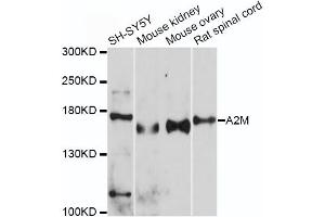 Western blot analysis of extracts of various cell lines, using A2M antibody (ABIN5970754) at 1/500 dilution. (alpha 2 Macroglobulin Antikörper)