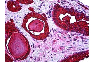 Anti-KLK3 / PSA antibody IHC of human prostate. (Prostate Specific Antigen Antikörper)