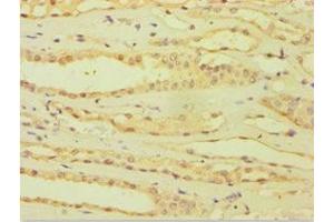 Immunohistochemistry of paraffin-embedded human kidney tissue using ABIN7144871 at dilution of 1:100 (ATP5J Antikörper  (AA 1-108))