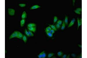 Immunofluorescent analysis of Hela cells using ABIN7175549 at dilution of 1:100 and Alexa Fluor 488-congugated AffiniPure Goat Anti-Rabbit IgG(H+L) (VMO1 Antikörper  (AA 25-202))