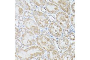 Immunohistochemistry of paraffin-embedded Mouse kidney using RPS18 antibody (ABIN6128660, ABIN6147205, ABIN6147206 and ABIN6215379) at dilution of 1:100 (40x lens). (RPS18 Antikörper  (AA 1-152))