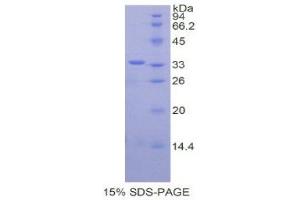 SDS-PAGE (SDS) image for CREB Binding Protein (CREBBP) (AA 2141-2442) protein (His tag) (ABIN2120917) (CBP Protein (AA 2141-2442) (His tag))