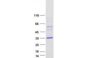 REP15 Protein (Myc-DYKDDDDK Tag)