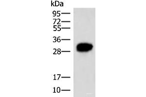 Western blot analysis of HepG2 cell lysate using HCCS Polyclonal Antibody at dilution of 1:4000 (HCCS Antikörper)