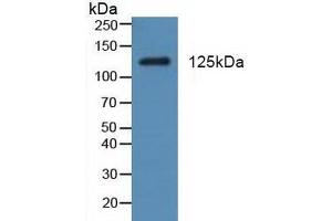 Figure. (PDGFRA Antikörper  (AA 170-387))