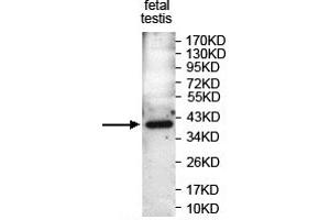 Western blot analysis of PAF Antibody using fetal testis Lysate at a dilution of 1/1000.