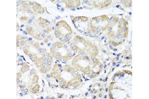 Immunohistochemistry of paraffin-embedded Human stomach using OPA3 Polyclonal Antibody at dilution of 1:100 (40x lens). (OPA3 Antikörper)