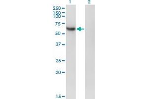 Western Blot analysis of RBPJ expression in transfected 293T cell line by RBPJ monoclonal antibody (M01A), clone 4E12. (RBPJ Antikörper  (AA 3-109))