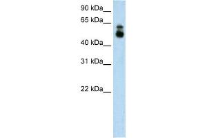 HDAC9 antibody used at 1. (HDAC9 Antikörper  (C-Term))