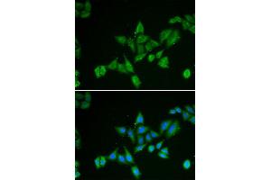 Immunofluorescence (IF) image for anti-BCL2/adenovirus E1B 19kDa Interacting Protein 2 (BNIP2) antibody (ABIN1980298) (BNIP2 Antikörper)