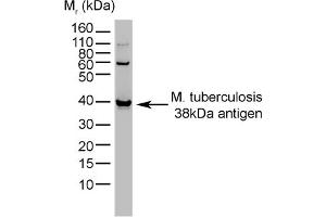 Western Blotting (WB) image for anti-Mycobacterium Tuberculosis (CFP10) antibody (ABIN316622) (CFP10 Antikörper)