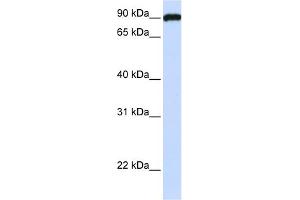 WB Suggested Anti-FAM62C Antibody Titration:  0. (ESYT3 Antikörper  (N-Term))