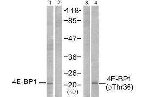 Western blot analysis of extracts from MDA-MB-435 cells, untreated or EGF-treated (200 ng/ml, 30min), using 4E-BP1 (Ab-36) antibody (E021215, Lane 1 and 2) and 4E-BP1 (phospho-Thr36) antibody (E011222, Lane 3 and 4). (eIF4EBP1 Antikörper  (pThr36))