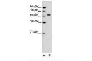 Image no. 1 for anti-SRY (Sex Determining Region Y)-Box 11 (SOX11) (N-Term) antibody (ABIN6736606) (SOX11 Antikörper  (N-Term))