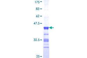 ABLIM1 Protein (AA 637-736) (GST tag)