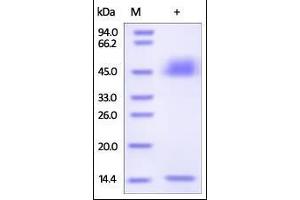 Rat FcRn / FCGRT & B2M on SDS-PAGE under reducing (R) condition. (FcRn Protein (AA 23-298) (His tag,Strep Tag))