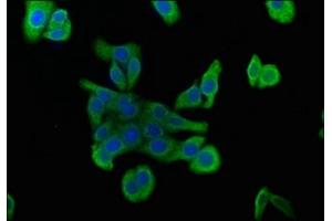 Immunofluorescence staining of HepG2 cells with ABIN7175710 at 1:100, counter-stained with DAPI. (MORG1 Antikörper  (AA 64-315))