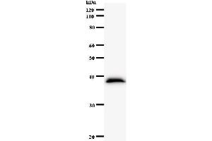 Western Blotting (WB) image for anti-NIMA related kinase 4 (NEK4) antibody (ABIN931149)