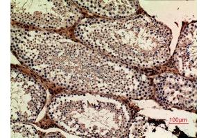 Immunohistochemistry (IHC) image for anti-Amyloid beta (A4) Precursor-Like Protein 1 (APLP1) (Internal Region) antibody (ABIN6283509)