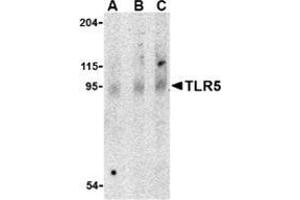 Western blot analysis of TLR5 in rat brain cell lysate with this product at (A) 0. (TLR5 Antikörper  (Center))