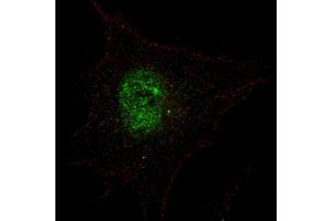 Fluorescent confocal image of SY5Y cells stained with phospho-PDX1-T11 antibody. (PDX1 Antikörper  (pThr11))