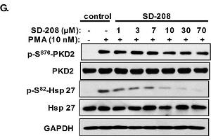 Western Blotting (WB) image for anti-Protein Kinase D2 (PKD2) antibody (ABIN2855325)