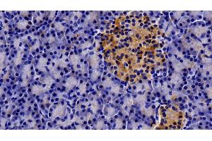 Immunohistochemistry (IHC) image for anti-Prolactin Receptor (PRLR) (AA 25-234) antibody (ABIN7443311)