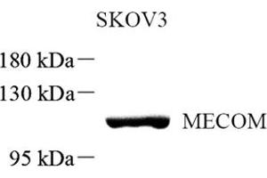 Western blot analysis of MECOM (ABIN7074575) at dilution of 1: 500 (MECOM Antikörper)