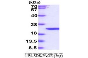 SDS-PAGE (SDS) image for Interferon, beta 1, Fibroblast (IFNB1) (AA 22-182) protein (His tag) (ABIN666768) (IFNB1 Protein (AA 22-182) (His tag))