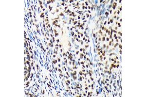 Immunohistochemistry of paraffin-embedded rat ovary using A Rabbit mAb (ABIN7265699) at dilution of 1:100 (40x lens). (ARID1A Antikörper)