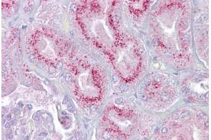 Immunohistochemistry (IHC) image for anti-Purinergic Receptor P2X, Ligand Gated Ion Channel 2 (P2RX2) (AA 108-157) antibody (ABIN959006)