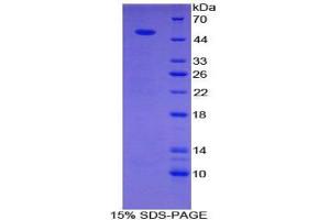 SDS-PAGE analysis of Human Semaphorin 4B Protein. (SEMA4B Protein)