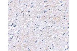 Immunohistochemical staining of human brain tissue using BAIAP3 polyclonal antibody  at 2. (BAIAP3 Antikörper  (N-Term))