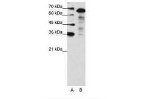 Image no. 2 for anti-MLX Interacting Protein-Like (MLXIPL) (N-Term) antibody (ABIN203213) (MLXIPL Antikörper  (N-Term))