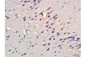 Formalin-fixed and paraffin embedded rat brain labeled with Rabbit Anti-RPS6KB1(Ser427) Polyclonal Antibody, Unconjugated  at 1:200 followed by conjugation to the secondary antibody and DAB staining (RPS6KB1 Antikörper  (pSer427))