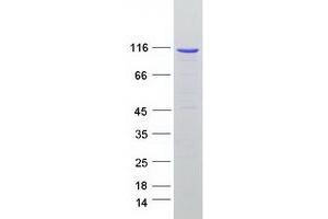 Western Blotting (WB) image for Coiled-Coil Domain Containing 135 (CCDC135) protein (Myc-DYKDDDDK Tag) (ABIN2712956)