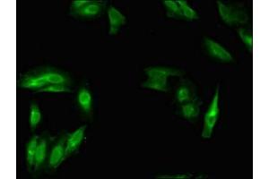 Immunofluorescent analysis of Hela cells using ABIN7160373 at dilution of 1:100 and Alexa Fluor 488-congugated AffiniPure Goat Anti-Rabbit IgG(H+L) (MSH4 Antikörper  (AA 501-800))