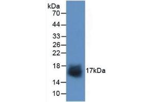 Detection of Recombinant SNCa, Human using Polyclonal Antibody to Synuclein Alpha (SNCa) (SNCA Antikörper  (AA 1-140))