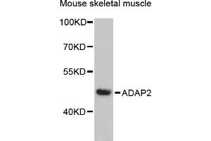Western blot analysis of extracts of mouse skeletal muscle, using  antibody (ABIN6131170, ABIN6136549, ABIN6136551 and ABIN6217841) at 1:3000 dilution.
