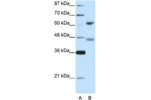 WB Suggested Anti-RFX4 Antibody Titration: 5.