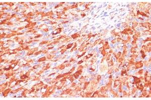 Immunohistochemistry of paraffin-embedded Rat ovary using ASNS Polyclonal Antibody at dilution of 1:100 (40x lens). (Asparagine Synthetase Antikörper)