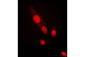 Immunofluorescent analysis of AKT2 staining in HepG2 cells. (AKT2 Antikörper  (C-Term))