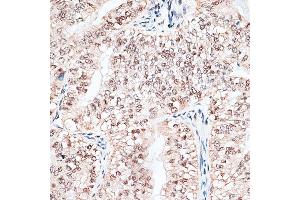 Immunohistochemistry (IHC) image for anti-RNA Binding Motif Protein 3 (RBM3) (AA 1-157) antibody (ABIN6146775)