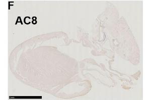 Immunohistochemistry of a left-sided rat heart for adenylyl cyclase AC8 (moderately positive) Source: PMID35625651 (ADCY8 Antikörper  (AA 151-250))