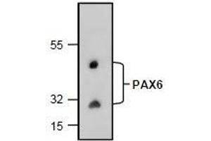 AP26353PU-N: Western blot analysis of PAX6 with rat kidney tissue lysate. (PAX6 Antikörper)