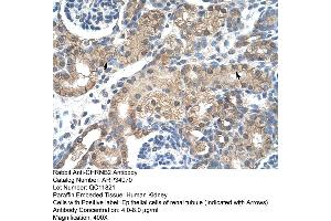 Immunohistochemistry (IHC) image for anti-Cholinergic Receptor, Nicotinic, beta 2 (Neuronal) (CHRNB2) (Middle Region) antibody (ABIN2776104)